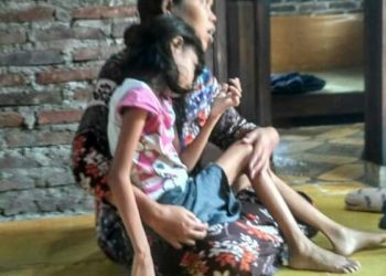 MIRIS, BOCAH PEREMPUAN BERUMUR 10 TAHUN HINGGA SAAT INI BELUM DIKETAHUI PENYAKITNYA, LUPUT DARI PERHATIAN PEMERINTAH