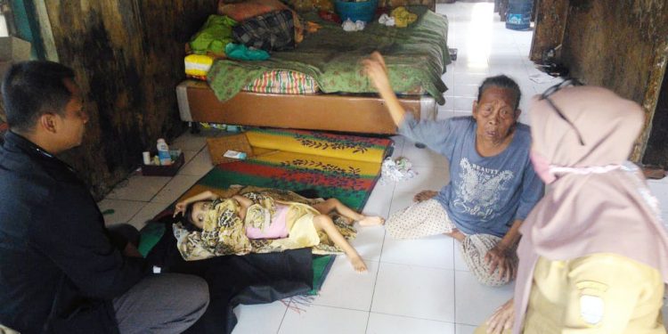 Terlahir Tidak Sempurna, Safira Bocah Malang Yang Membutuhkan Perhatian