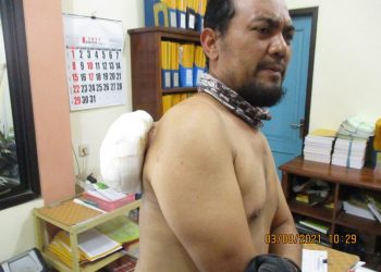 Derita Tumor Sebesar Kepala Edi Haryanto, Butuh Bantuan Untuk Operasi
